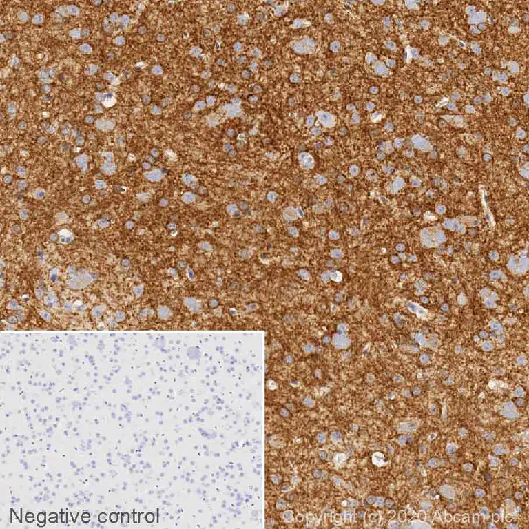 Immunohistochemistry (Formalin/PFA-fixed paraffin-embedded sections) - Anti-Adenosine Receptor A2a antibody [7F6-G5-A2] (AB79714)