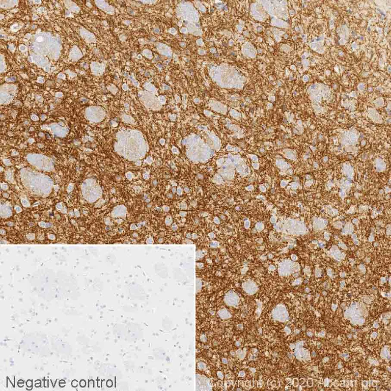 Immunohistochemistry (Formalin/PFA-fixed paraffin-embedded sections) - Anti-Adenosine Receptor A2a antibody [7F6-G5-A2] (AB79714)