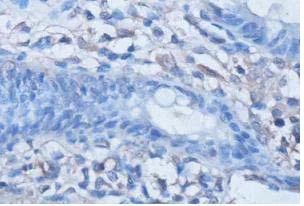 Immunohistochemistry (Formalin/PFA-fixed paraffin-embedded sections) - Anti-Adenosine Receptor A2a antibody (AB101678)