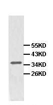 Western blot - Anti-Adenosine Receptor A2a antibody (AB101678)