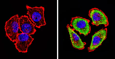 Immunocytochemistry - Anti-Adenosine Receptor A2a antibody (AB3461)