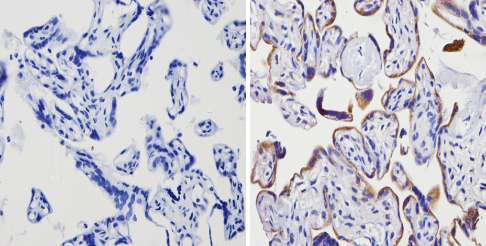 Immunohistochemistry (Formalin/PFA-fixed paraffin-embedded sections) - Anti-Adenosine Receptor A2a antibody (ab3461), expandable thumbnail