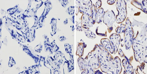 Immunohistochemistry (Formalin/PFA-fixed paraffin-embedded sections) - Anti-Adenosine Receptor A2a antibody (AB3461)