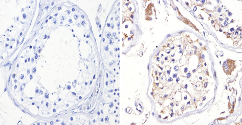 Immunohistochemistry (Formalin/PFA-fixed paraffin-embedded sections) - Anti-Adenosine Receptor A2a antibody (AB3461), expandable thumbnail