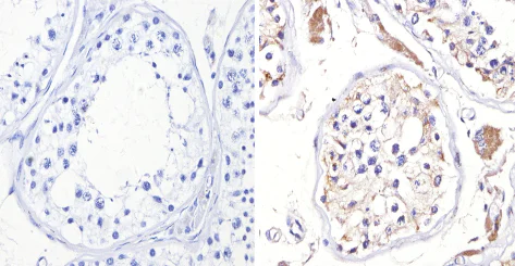 Immunohistochemistry (Formalin/PFA-fixed paraffin-embedded sections) - Anti-Adenosine Receptor A2a antibody (AB3461)
