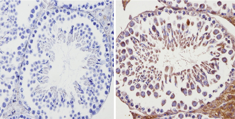 Immunohistochemistry (Formalin/PFA-fixed paraffin-embedded sections) - Anti-Adenosine Receptor A2a antibody (AB3461), expandable thumbnail
