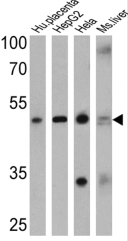 Western blot - Anti-Adenosine Receptor A2a antibody (AB3461), expandable thumbnail
