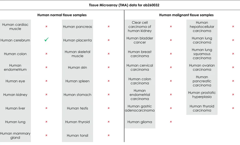 Immunohistochemistry (Formalin/PFA-fixed paraffin-embedded sections) - Anti-Adenosine Receptor A2a antibody [EPR23731-50] (AB260032)