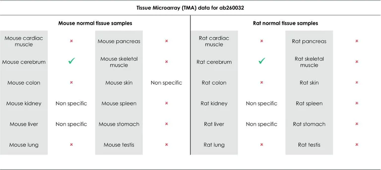 Immunohistochemistry (Formalin/PFA-fixed paraffin-embedded sections) - Anti-Adenosine Receptor A2a antibody [EPR23731-50] (AB260032)