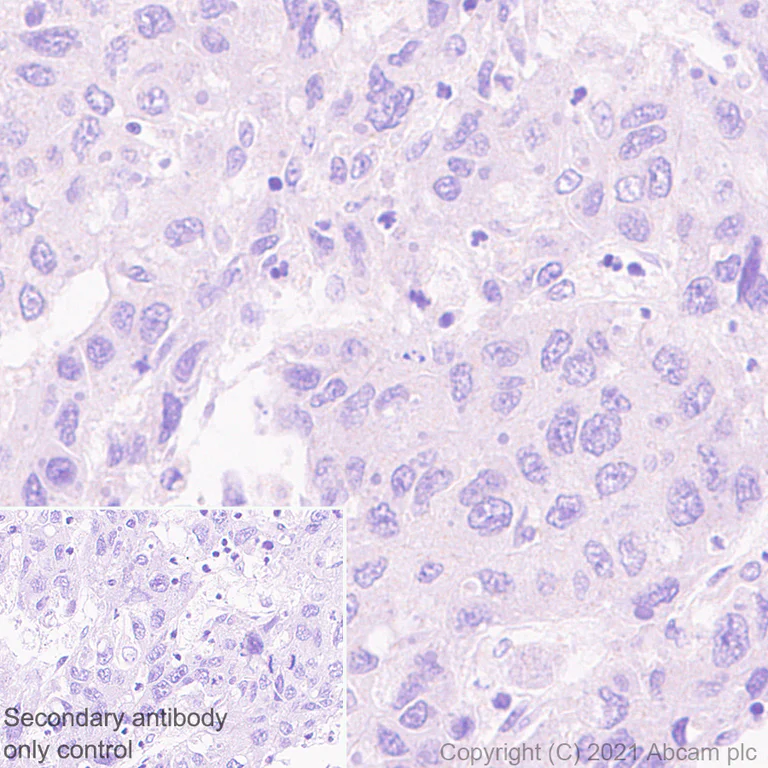 Immunohistochemistry (Formalin/PFA-fixed paraffin-embedded sections) - Anti-Adenosine Receptor A2a antibody [EPR23731-50] - BSA and Azide free (AB273879)