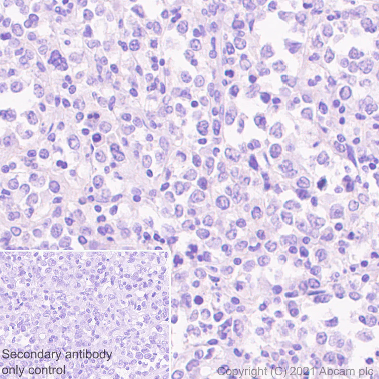 Immunohistochemistry (Formalin/PFA-fixed paraffin-embedded sections) - Anti-Adenosine Receptor A2a antibody [EPR23731-50] - BSA and Azide free (AB273879)