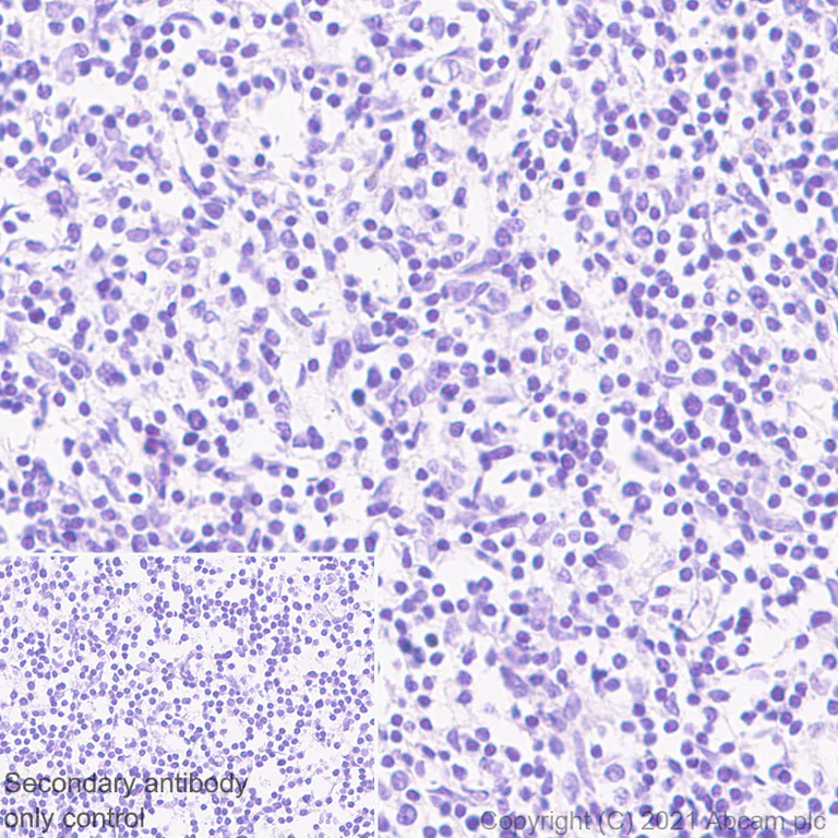 Immunohistochemistry (Formalin/PFA-fixed paraffin-embedded sections) - Anti-Adenosine Receptor A2a antibody [EPR23731-50] - BSA and Azide free (AB273879)