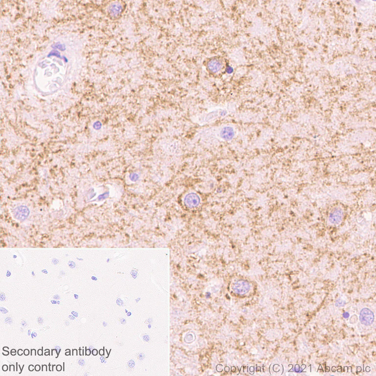 Immunohistochemistry (Formalin/PFA-fixed paraffin-embedded sections) - Anti-Adenosine Receptor A2a antibody [EPR23731-50] - BSA and Azide free (AB273879)