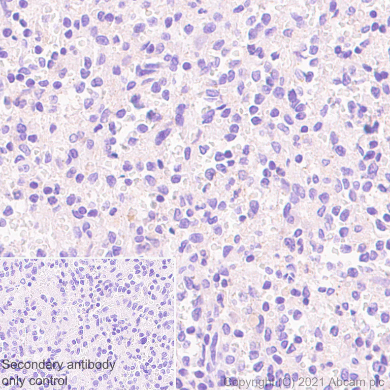 Immunohistochemistry (Formalin/PFA-fixed paraffin-embedded sections) - Anti-Adenosine Receptor A2a antibody [EPR23731-50] - BSA and Azide free (AB273879)