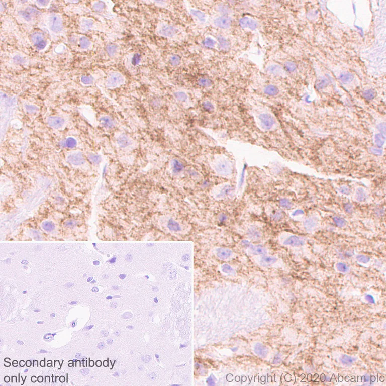 Immunohistochemistry (Formalin/PFA-fixed paraffin-embedded sections) - Anti-Adenosine Receptor A2a antibody [EPR23731-50] - BSA and Azide free (AB273879)