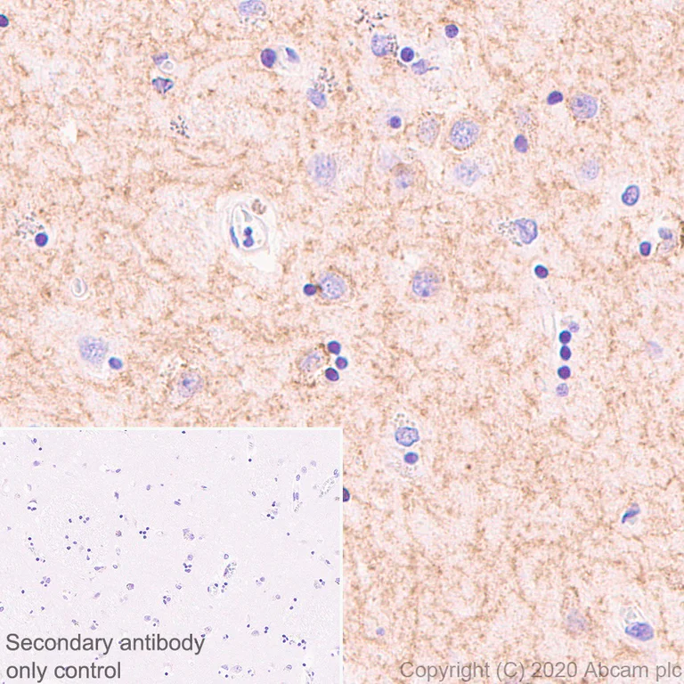 Immunohistochemistry (Formalin/PFA-fixed paraffin-embedded sections) - Anti-Adenosine Receptor A2a antibody [EPR23731-50] - BSA and Azide free (AB273879)