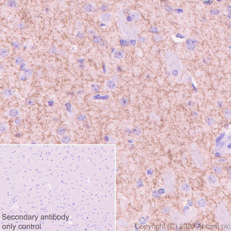Immunohistochemistry (Formalin/PFA-fixed paraffin-embedded sections) - Anti-Adenosine Receptor A2a antibody [EPR23731-50] - BSA and Azide free (AB273879)