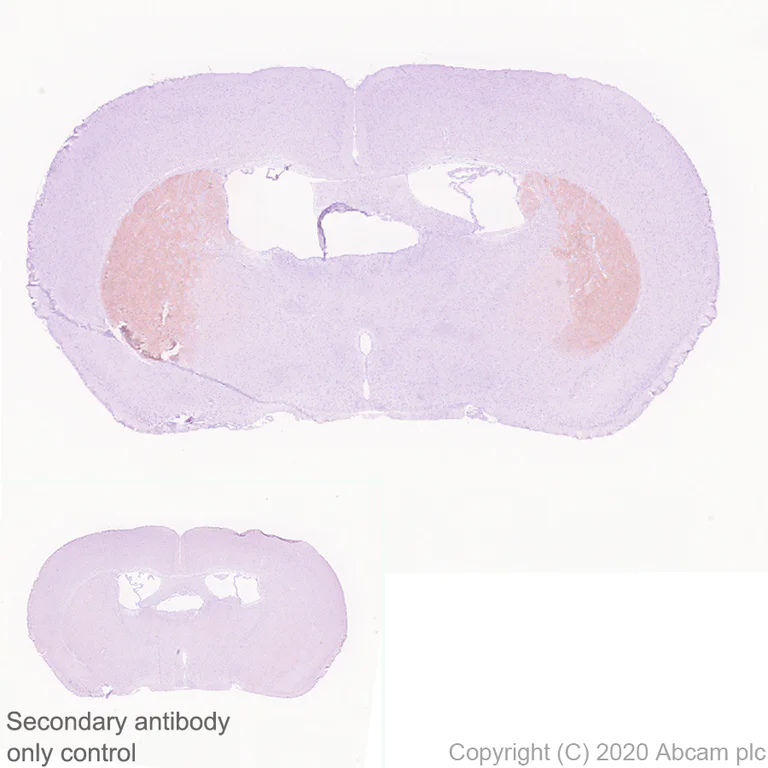 Immunohistochemistry (Formalin/PFA-fixed paraffin-embedded sections) - Anti-Adenosine Receptor A2a antibody [EPR23731-50] - BSA and Azide free (AB273879)