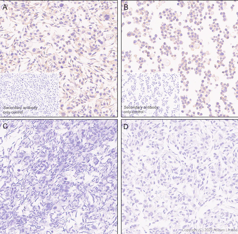 Immunohistochemistry (Formalin/PFA-fixed paraffin-embedded sections) - Anti-Adenosine Receptor A2a antibody [EPR28040-78] (AB325013)