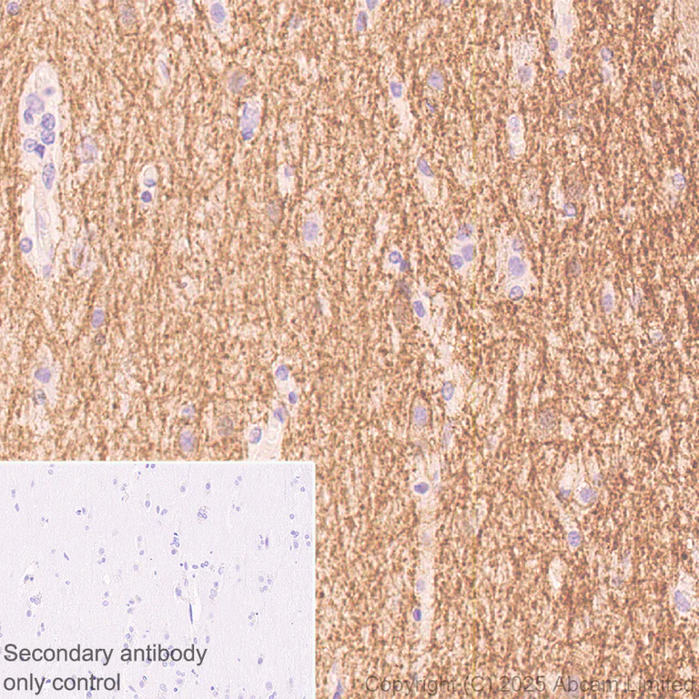 Immunohistochemistry (Formalin/PFA-fixed paraffin-embedded sections) - Anti-Adenosine Receptor A2a antibody [EPR28040-78] - BSA and Azide free (AB325022)