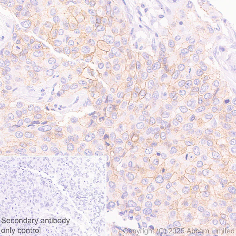Immunohistochemistry (Formalin/PFA-fixed paraffin-embedded sections) - Anti-Adenosine Receptor A2a antibody [EPR28040-78] - BSA and Azide free (AB325022)