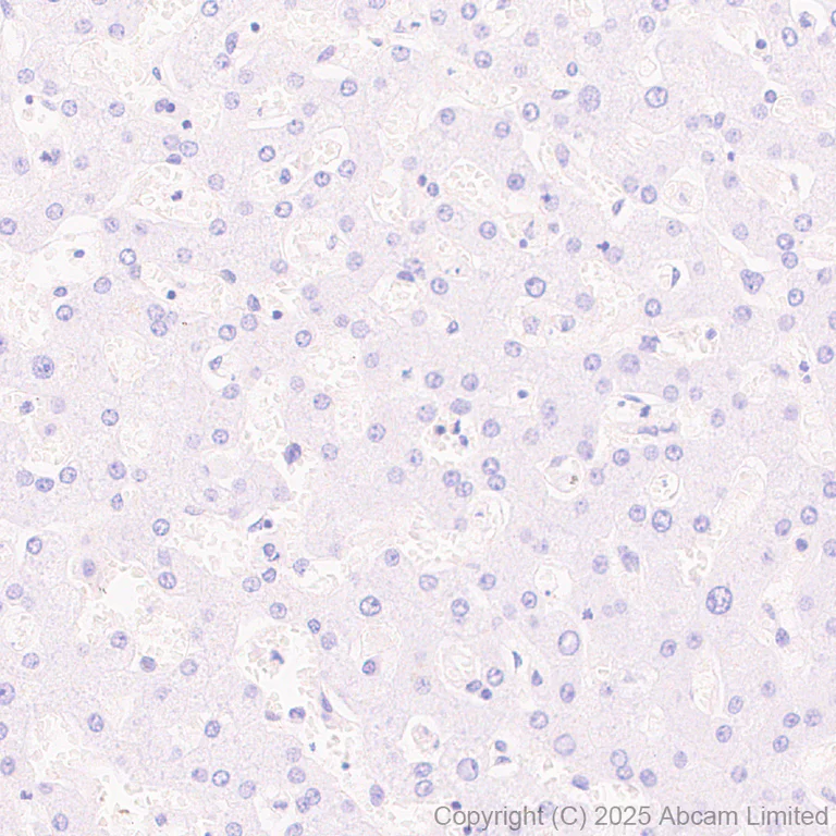 Immunohistochemistry (Formalin/PFA-fixed paraffin-embedded sections) - Anti-Adenosine Receptor A2a antibody [EPR28040-78] - BSA and Azide free (AB325022)