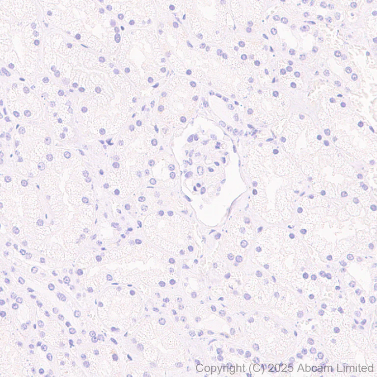 Immunohistochemistry (Formalin/PFA-fixed paraffin-embedded sections) - Anti-Adenosine Receptor A2a antibody [EPR28040-78] - BSA and Azide free (AB325022)