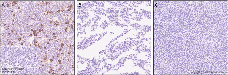 Immunohistochemistry (Formalin/PFA-fixed paraffin-embedded sections) - Anti-Adenosine Receptor A2a antibody [EPR28040-78] - BSA and Azide free (AB325022)