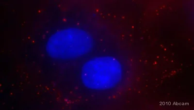 Immunocytochemistry/ Immunofluorescence - Anti-Adenovirus Type 5 antibody (AB6982)