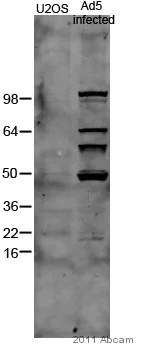 Western blot - Anti-Adenovirus Type 5 antibody (AB6982)