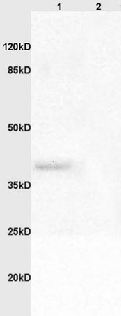 Western blot - Anti-Adenovirus Type 5 E1A antibody (AB204123)