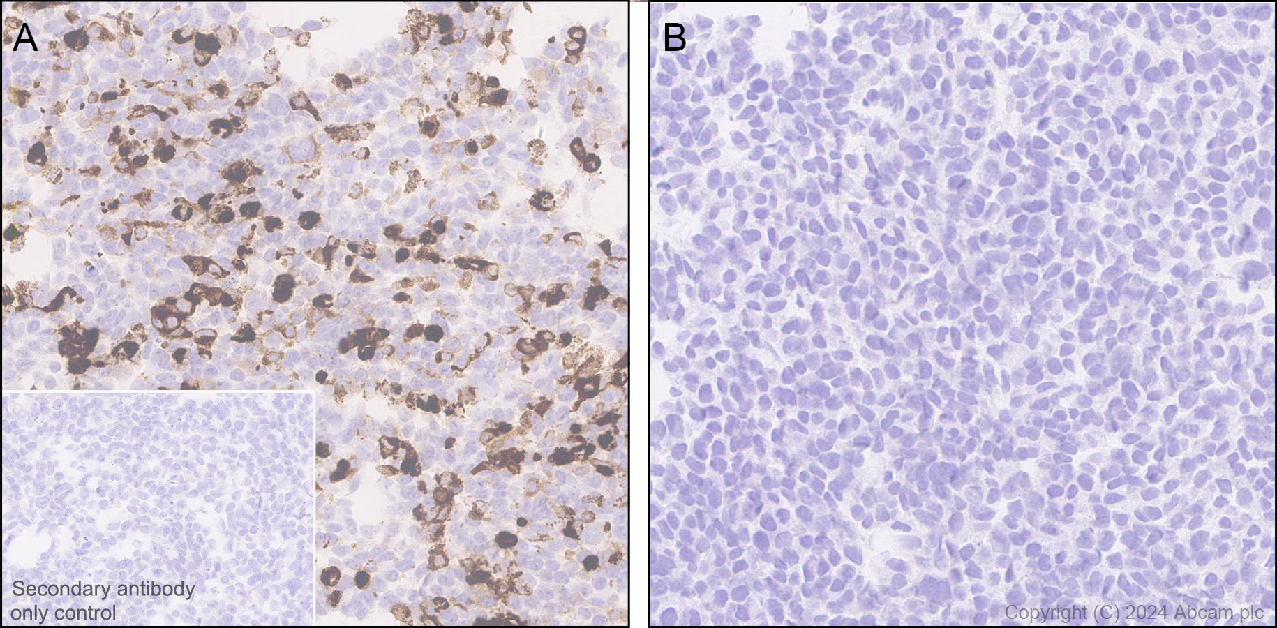 Immunohistochemistry (Formalin/PFA-fixed paraffin-embedded sections) - Anti-Adenovirus Type 5 Hexon antibody [EPR28237-57] (ab316852), expandable thumbnail
