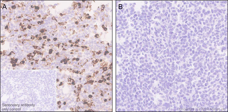 Immunohistochemistry (Formalin/PFA-fixed paraffin-embedded sections) - Anti-Adenovirus Type 5 Hexon antibody [EPR28237-57] (AB316852)