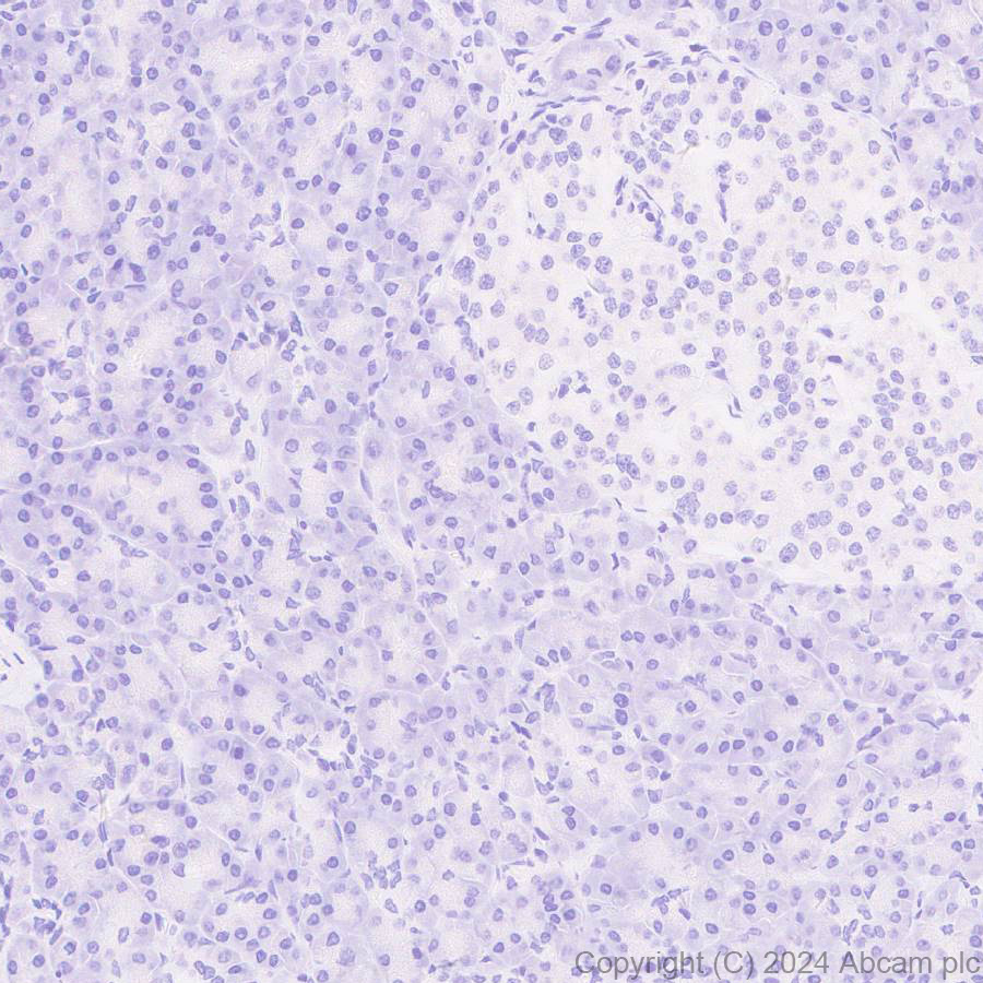 Immunohistochemistry (Formalin/PFA-fixed paraffin-embedded sections) - Anti-Adenovirus Type 5 Hexon antibody [EPR28237-57] (ab316852), expandable thumbnail