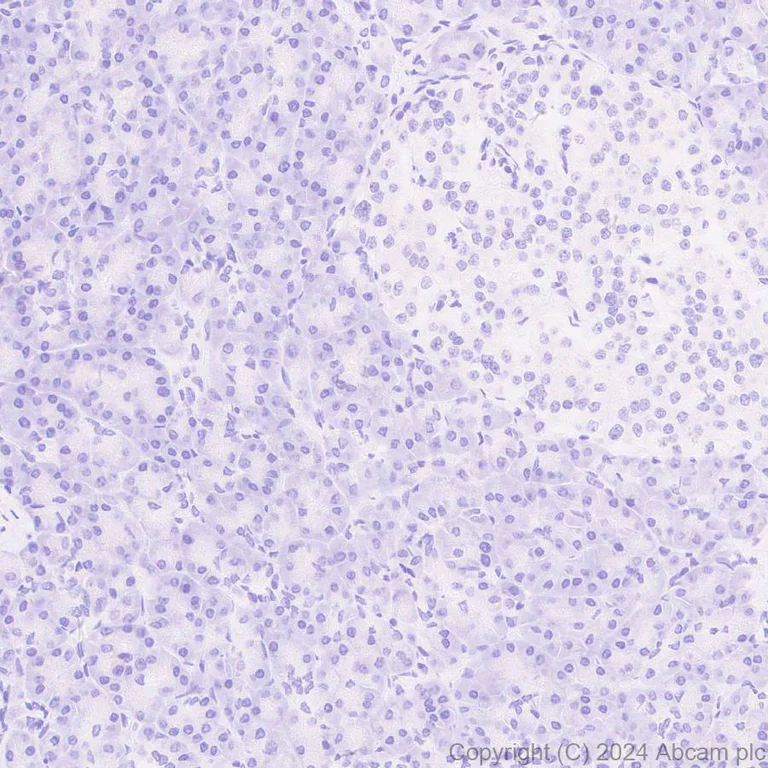 Immunohistochemistry (Formalin/PFA-fixed paraffin-embedded sections) - Anti-Adenovirus Type 5 Hexon antibody [EPR28237-57] (AB316852)