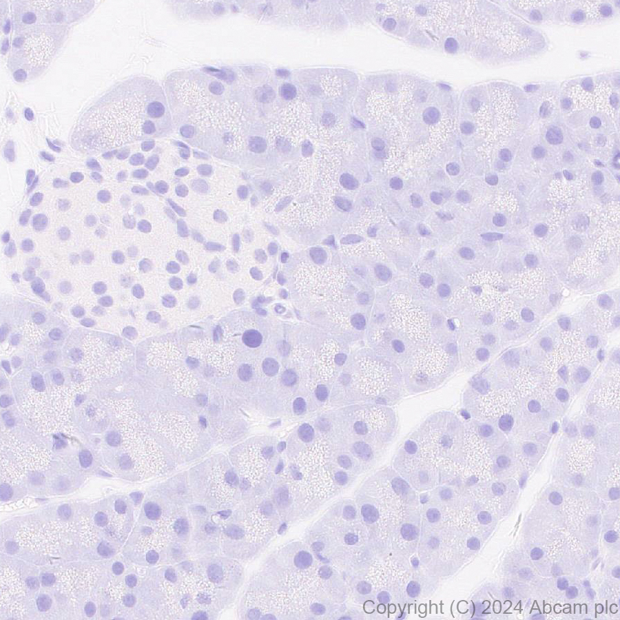 Immunohistochemistry (Formalin/PFA-fixed paraffin-embedded sections) - Anti-Adenovirus Type 5 Hexon antibody [EPR28237-57] (ab316852), expandable thumbnail