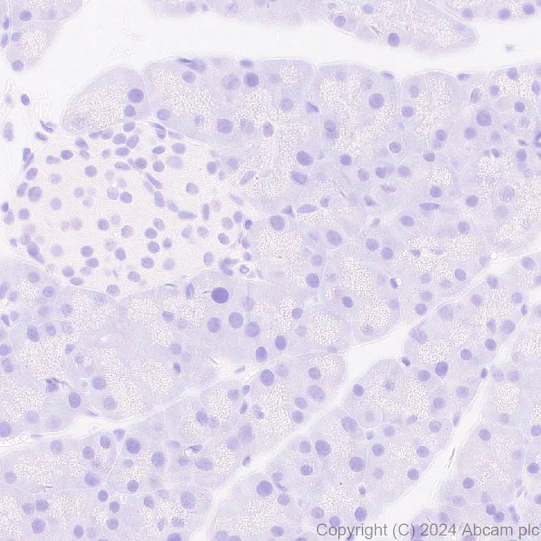 Immunohistochemistry (Formalin/PFA-fixed paraffin-embedded sections) - Anti-Adenovirus Type 5 Hexon antibody [EPR28237-57] (AB316852)