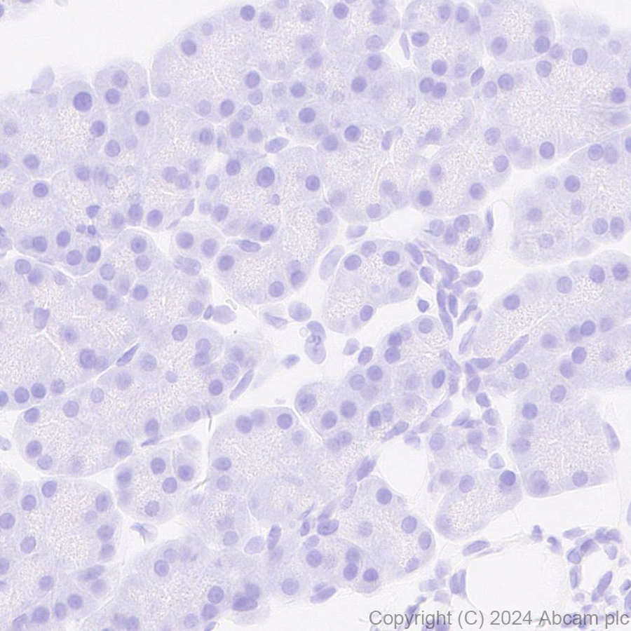 Immunohistochemistry (Formalin/PFA-fixed paraffin-embedded sections) - Anti-Adenovirus Type 5 Hexon antibody [EPR28237-57] (ab316852), expandable thumbnail