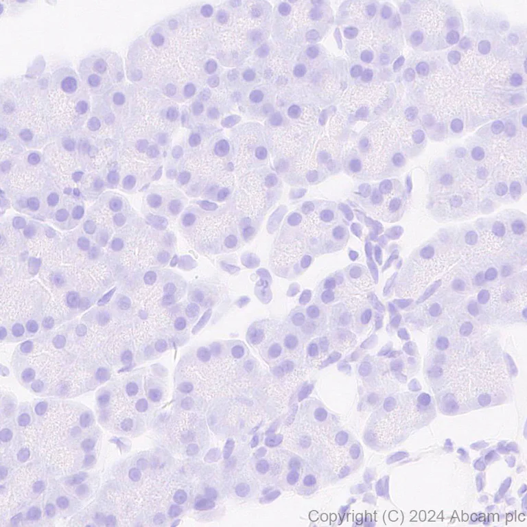 Immunohistochemistry (Formalin/PFA-fixed paraffin-embedded sections) - Anti-Adenovirus Type 5 Hexon antibody [EPR28237-57] (AB316852)