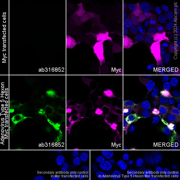 Immunocytochemistry/ Immunofluorescence - Anti-Adenovirus Type 5 Hexon antibody [EPR28237-57] - BSA and Azide free (AB316853)