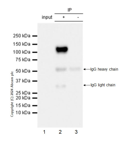 Immunoprecipitation - Anti-Adenovirus Type 5 Hexon antibody [EPR28237-57] - BSA and Azide free (AB316853), expandable thumbnail