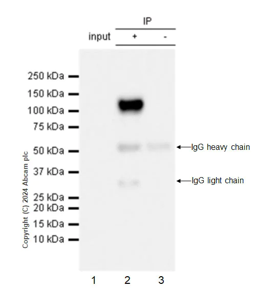 Immunoprecipitation - Anti-Adenovirus Type 5 Hexon antibody [EPR28237-57] - BSA and Azide free (AB316853)