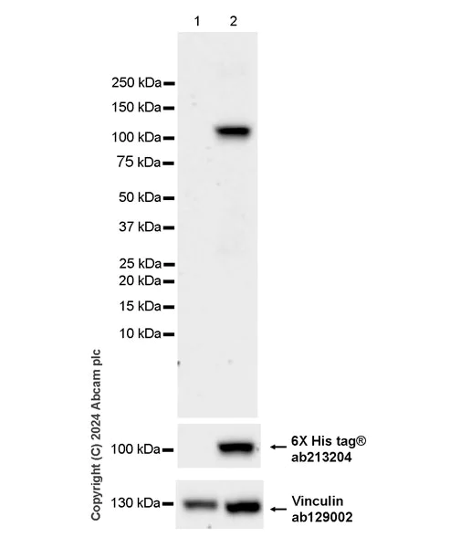 Western blot - Anti-Adenovirus Type 5 Hexon antibody [EPR28237-57] - BSA and Azide free (AB316853)