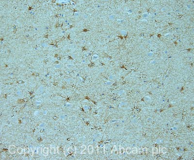 Immunohistochemistry (Formalin/PFA-fixed paraffin-embedded sections) - Anti-Adenylate cyclase 1/AC1 antibody (AB69597)