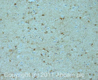 Immunohistochemistry (Formalin/PFA-fixed paraffin-embedded sections) - Anti-Adenylate cyclase 1/AC1 antibody (AB69597)