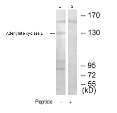 Western blot - Anti-Adenylate cyclase 1/AC1 antibody (AB69597)