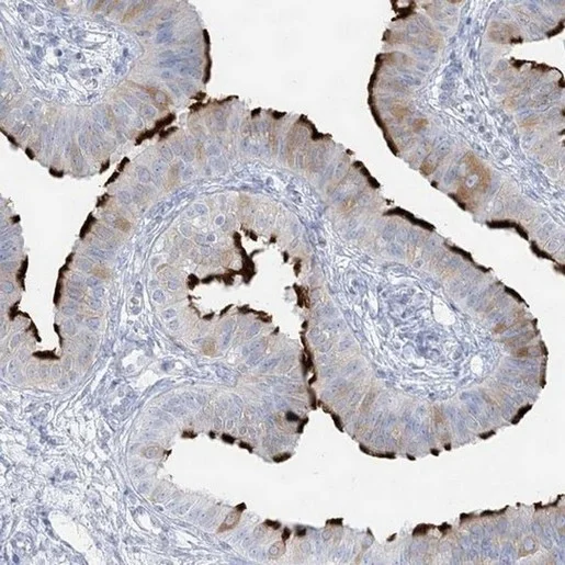 Immunohistochemistry (Formalin/PFA-fixed paraffin-embedded sections) - Anti-ADGB/Androglobin antibody (AB204085)