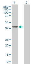 Western blot - Anti-ADH1C antibody (AB168748)