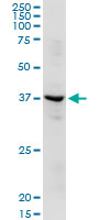 Western blot - Anti-ADH1C antibody (AB168748)