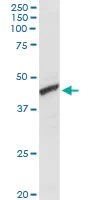 Western blot - Anti-ADH1C antibody (AB168748)